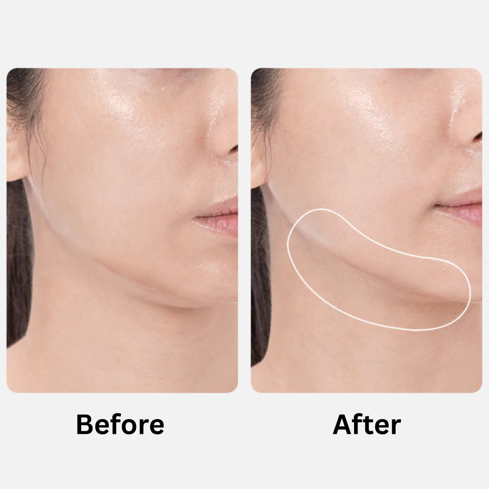 MEDICUBE Beauty device - AGE-R BOOSTER PRO (Black / Pink)